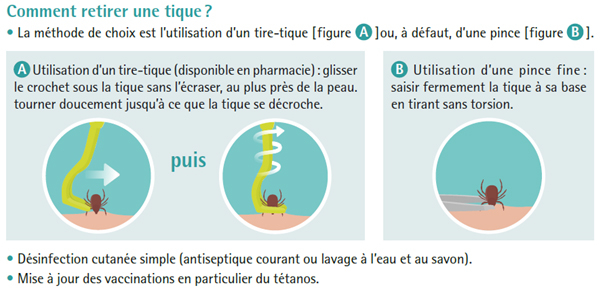 comment retirer une tique