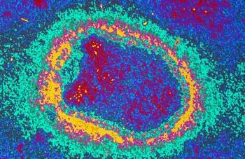 Virus de la rage - Institut Pasteur