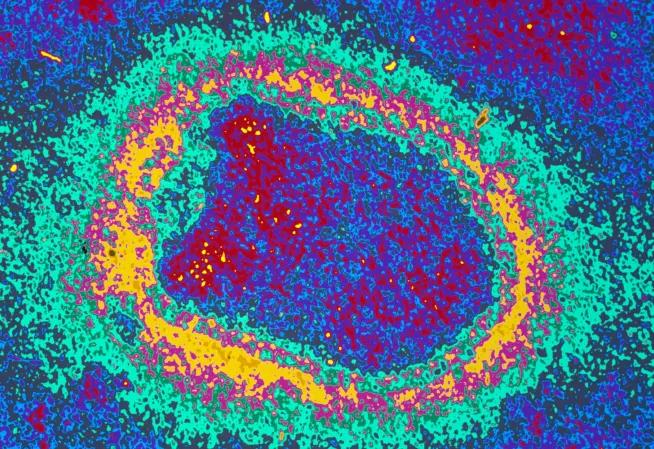 Virus de la rage - Institut Pasteur
