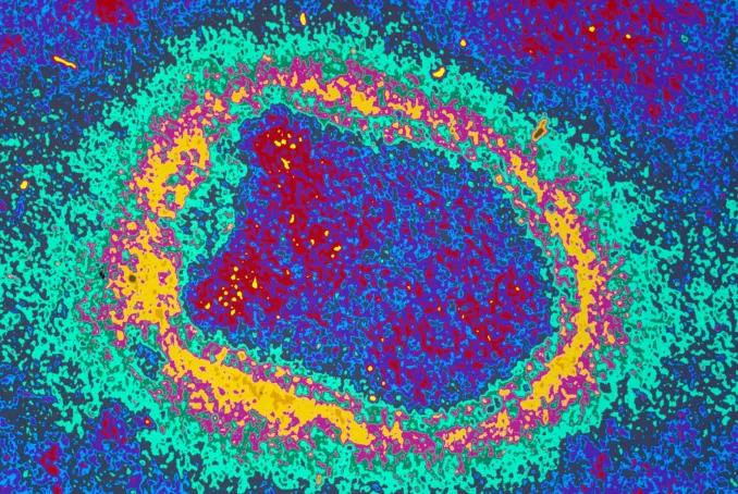 Virus de la rage - Institut Pasteur